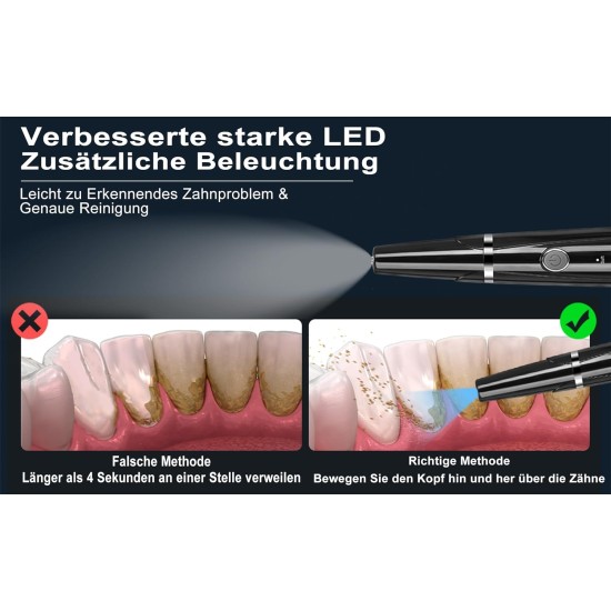 Teeth Cleaning Set, Teeth Cleaning Set with Five Adjustable Modes, Suitable for Home Care, Teeth Whitening Set for Human/Dog/Cat, Black Teeth Cleaning Set, Teeth Cleaning Set with Five Adjustable Modes, Suitable for Home Care, Teeth Whitening Set for Human/Dog/Cat, Black