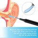NICENEEDED Pack of 150 Replacement Tips for Ear Cleaners, Replacement Silicone Ear Tip Covers for Ear Spoons, Replacement Accessories for Ear Wax Cleaning of the Otoscope NICENEEDED Pack of 150 Replacement Tips for Ear Cleaners, Replacement Silicone Ear Tip Covers for Ear Spoons, Replacement Accessories for Ear Wax Cleaning of the Otoscope