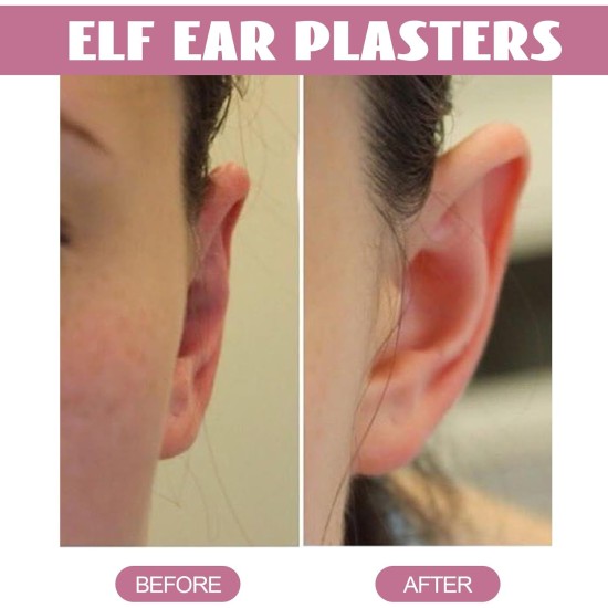 Pack of 30 Cosmetic Ear Corrector Ear Corrector, Self-Adhesive Elf Ear Patches, Concealed Cosmetic Ear Corrector for Protruding Ears Pack of 30 Cosmetic Ear Corrector Ear Corrector, Self-Adhesive Elf Ear Patches, Concealed Cosmetic Ear Corrector for Protruding Ears